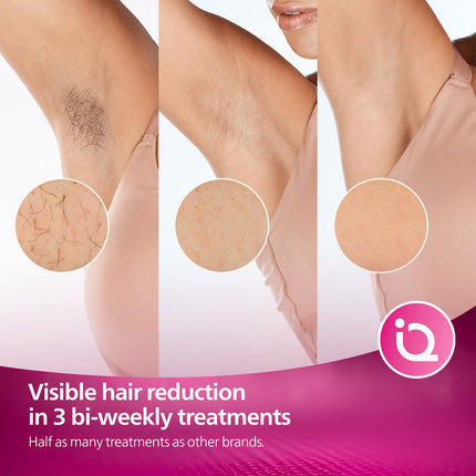 Philips Lumea IPL | Hair Removal | 7000 Series | Skintone Sensor | 2 Attachments | Body, Face | Compact Pen Trimmer | Corded Use | BRI921/60